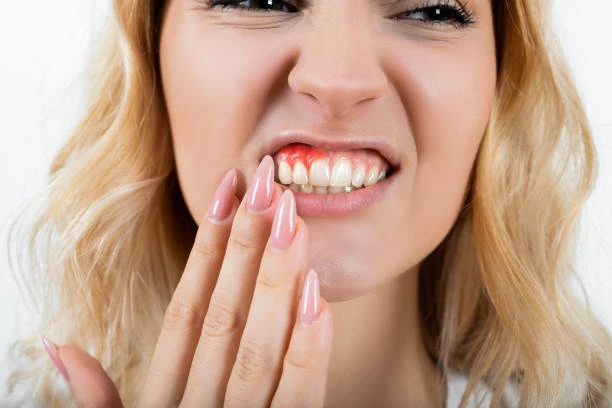 overview of gum disease
