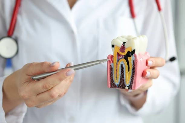 what is cavity