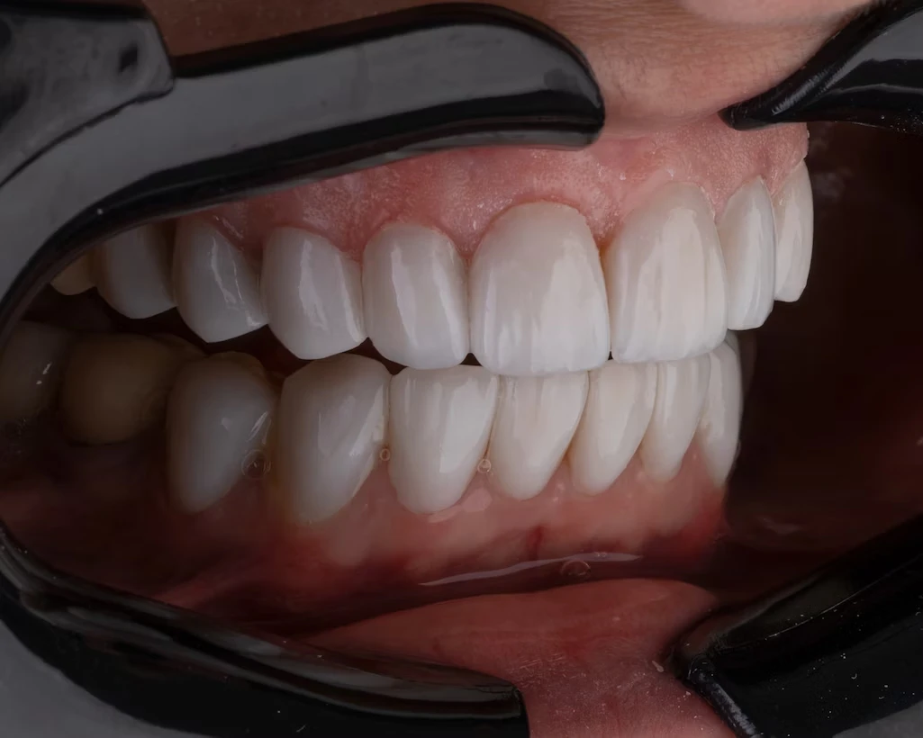teeth (1)