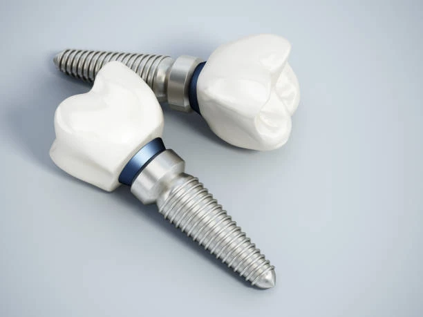 how long does it take to get dental implants (1)