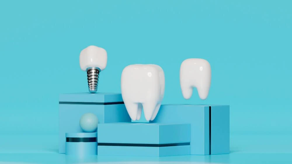 all on 4 dental implants and its benefits