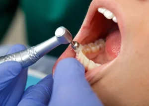 what should you know about dental cleanings