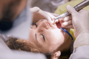 an image of a woman during a dental procedure