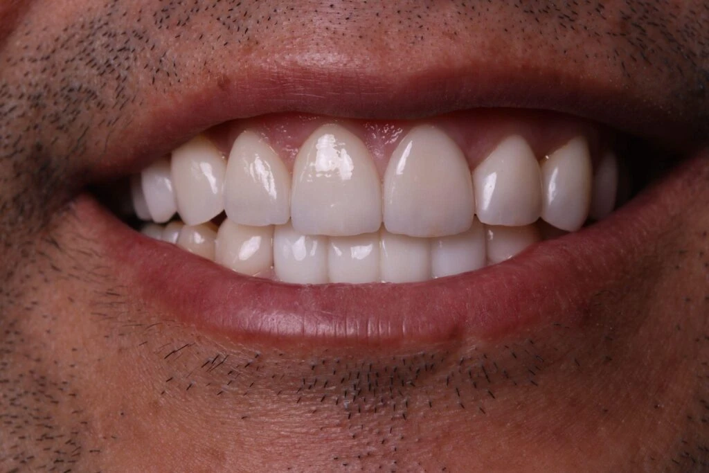 cosmetic client after
