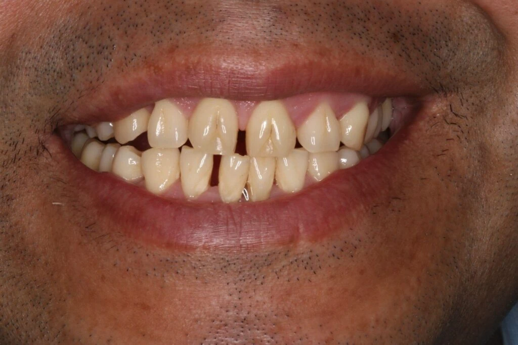 cosmetic client before