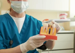 Dental professional holding an implant model to explain tooth implant lifespan and long-term replacement.
